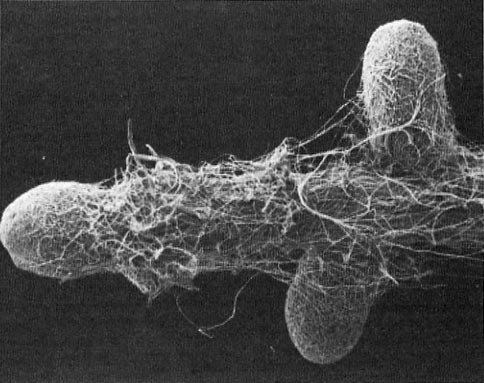 long structure with two shorter branches growing out on either side at about an 80 degree angle (eucalypt ectomycorrhiza) with a fairly thick moss or web-like mantle covering the surface of the structure