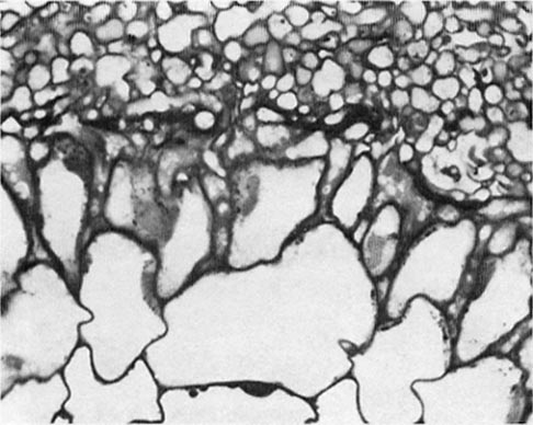 Magnification of the center of the transverse section through an ectomycorrhiza of red alder; black fungus surrounds white areas.